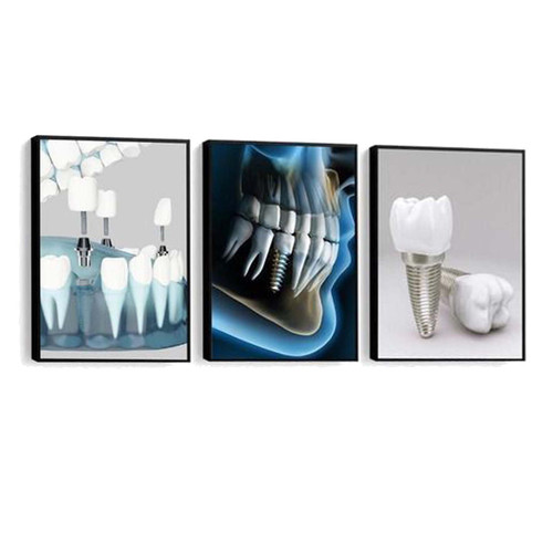 تابلو دکوراتیو هپی لند مدل ایمپلنت دندانپزشکی 15